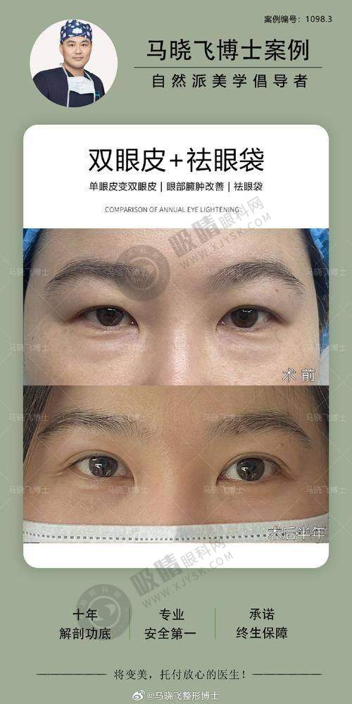 2. 佛山佳丽整形有哪些特色医美项目和价格？