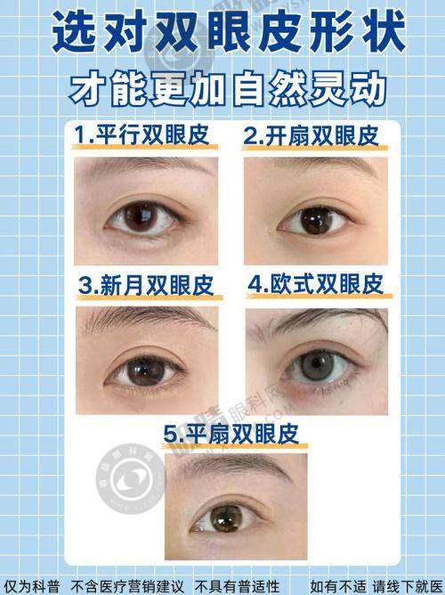 三、南京割双眼皮项目收费情况