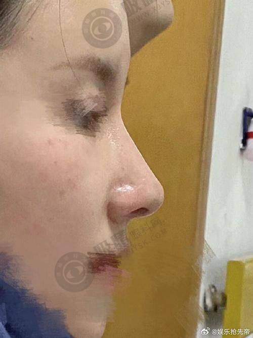 佛山佳丽整形正规靠谱吗？卫生部认证、千级层流手术室，隆鼻低至4800元起！