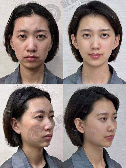 3. 宁波菁漾轻医美医资力量