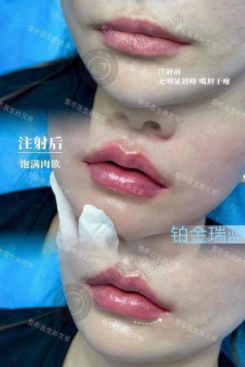 7. 兰州千雨医疗美容整形医院联系我们