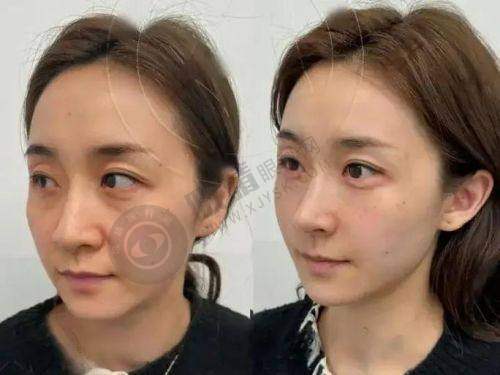 4. 兰州千雨医疗美容整形医院特色项目