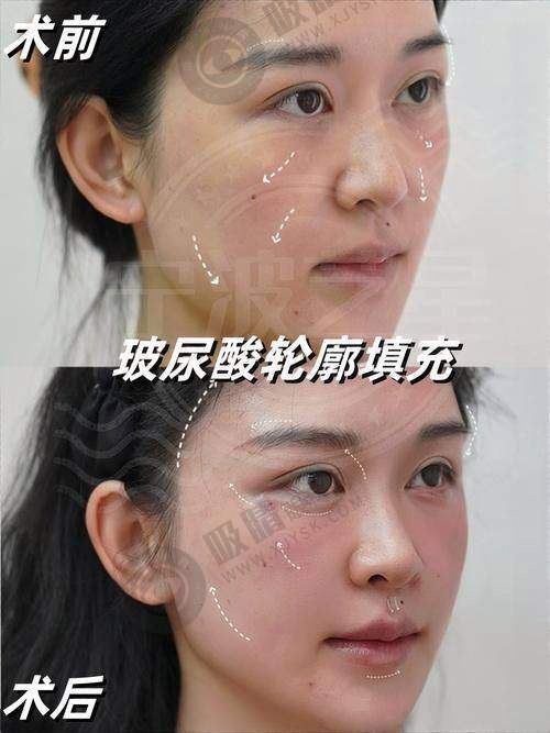 宁波菁漾轻医美