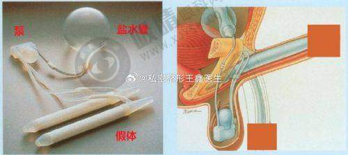 2. 杭州阿波罗医院核心优势