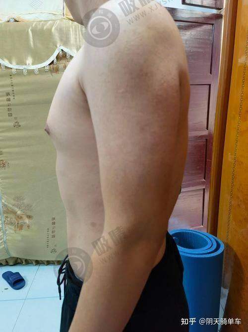 5. 杭州阿波罗医院价格