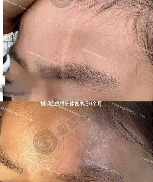 5. 上海新华医院——整形突出，服务优质