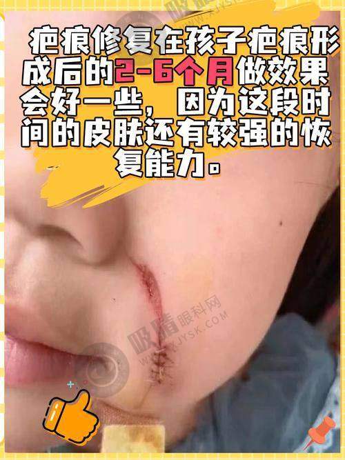 4. 上海市第六人民医院——整形专长，疗效显著
