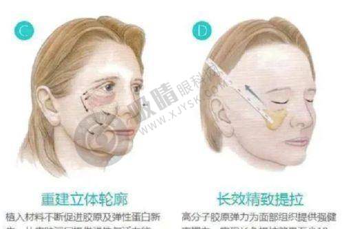楚雄中医院皮肤科2025价格表：多样项目合理收费
