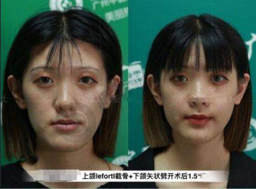 武汉多家医院手术疤痕修复服务介绍