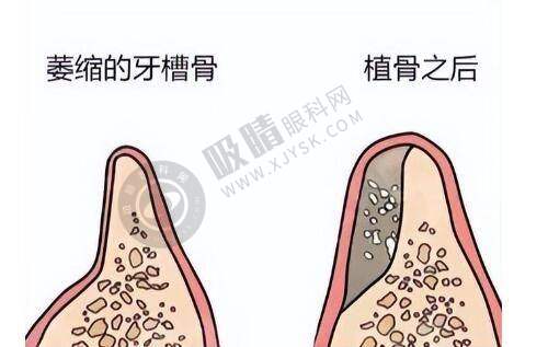 4. 北京奥尔贝德整形的价格贵吗?