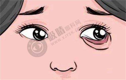 武汉艺星医疗美容医院科普隆胸知识