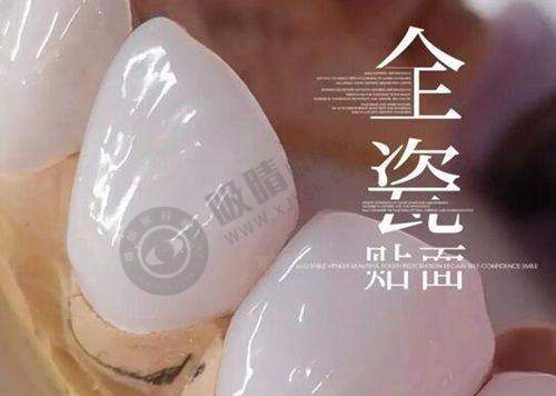 南宁柏乐口腔收费标准探讨