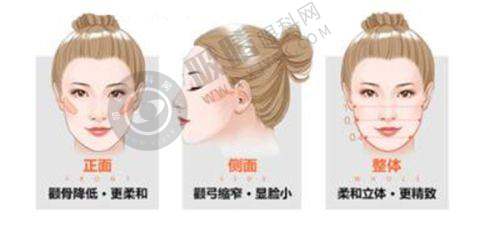 王召东医生拉皮手术怎么样？靠谱效果好，揭秘让您自然年轻10岁的秘密武器！