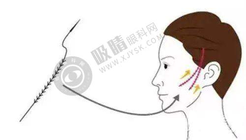 遵义汇川广慈医院——遵义正规整形的优质之选