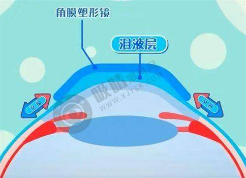 衡水眼科医院哪家强？爱尔、复明、同瑞技术领先口碑佳