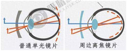 北京眼科医院排名top3公布！民众眼科飞秒手术领跑，爱尔与茗视佳谁更胜一筹？