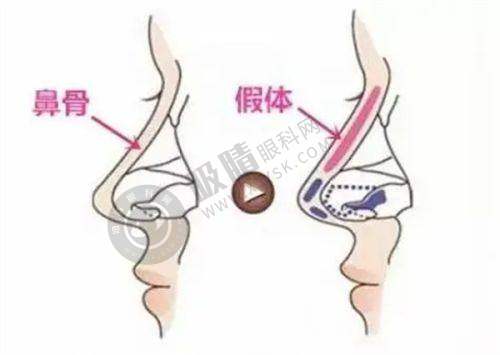 武汉手术疤痕修复结语
