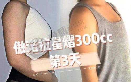 重庆真熙美熙整形门诊部价格表 / 收费标准