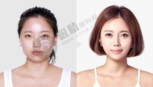 重庆丽瑾亚美美容医院来院路线