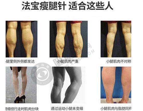 重庆丝粟植发医院价格表 / 收费标准