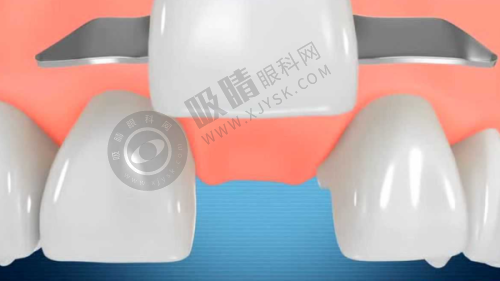 重庆江津佳成口腔医院预约挂号方式及流程