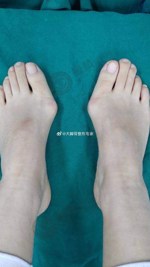 [重庆长城骨科医院]特色项目及技术优势