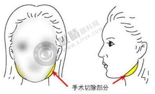 重庆真熙美熙整形门诊部怎么样？美杜莎美眼+4D隆鼻技术强，九龙坡区口碑整形专科