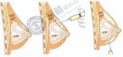 [武汉同济医学院医院]患者评价
