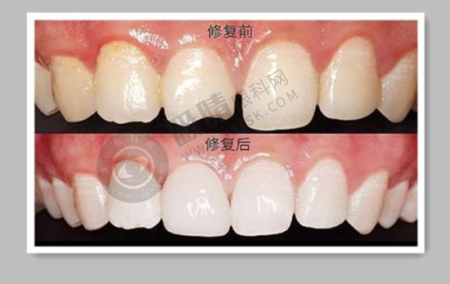 云阳县云州口腔医院怎么样？二级专科资质+30台牙椅规模，傅晓鹭医生隐形矫正技术获赞