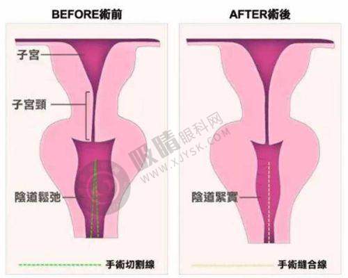 昆明杰西艾美容医院怎么去？地址电话+公交地铁自驾全攻略速收藏！