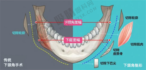 重庆唐森植发医院怎么样？在哪里？南岸总部+两江分院，FUE无痕植发4元起/单位限时特惠
