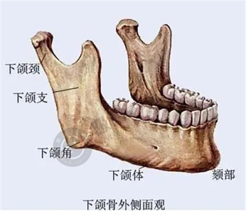 颧骨内推效果能维持多久？李运峰医生成都东篱医院打造360°精致小脸