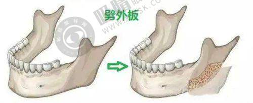 重庆丝粟植发医院怎么样:医院口碑反馈