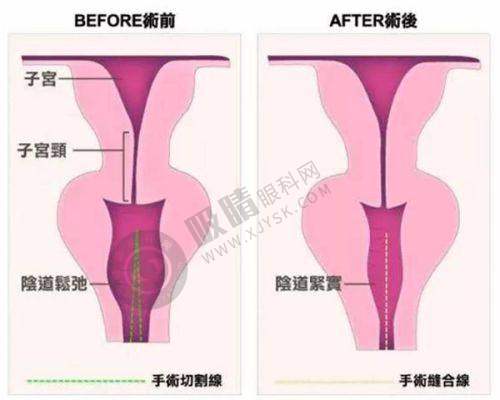 [深圳罗文医疗美容诊所]价格表 / 收费标准