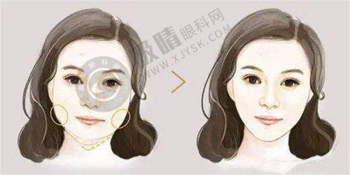 [浙江台州艺星医疗美容医院]患者评价