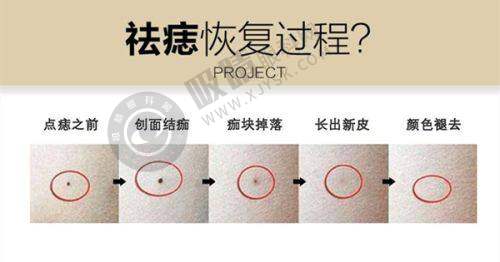 重庆紫城医疗整形美容门诊部怎么样？正规靠谱、瑞士抗衰管理+射频紧肤项目效果惊艳