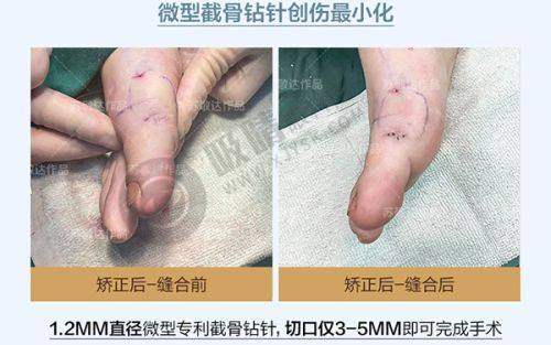 3. 姚盛雷医生的学术成果