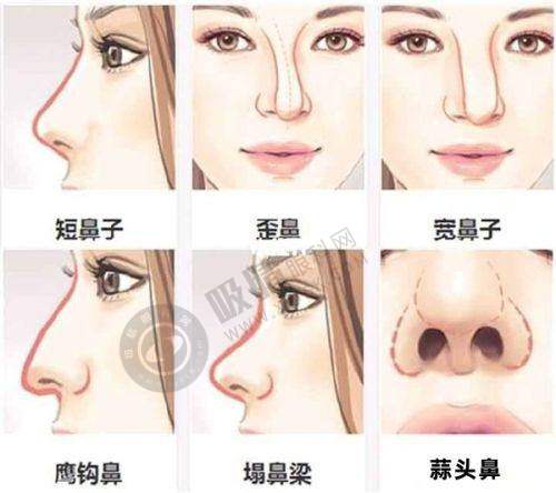 2. 成浩医生：擅长多项特色整形技术