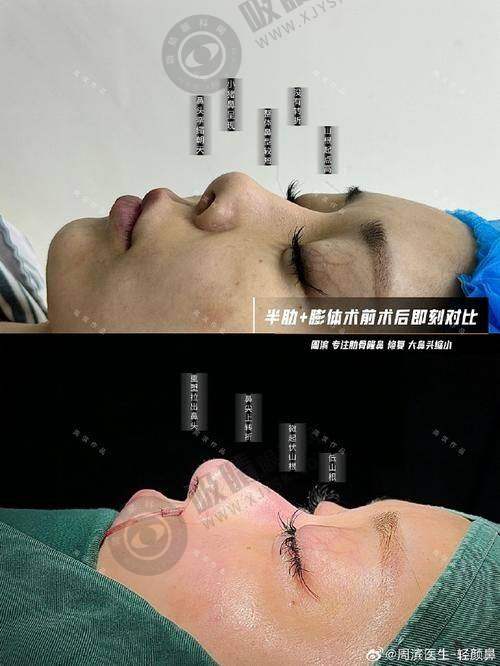 东莞爱思特（原华美）医疗美容口腔门诊
