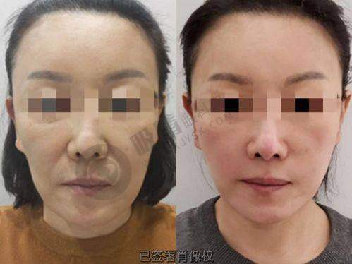 大理金阁医疗美容医院——大理值得信赖的整形医院
