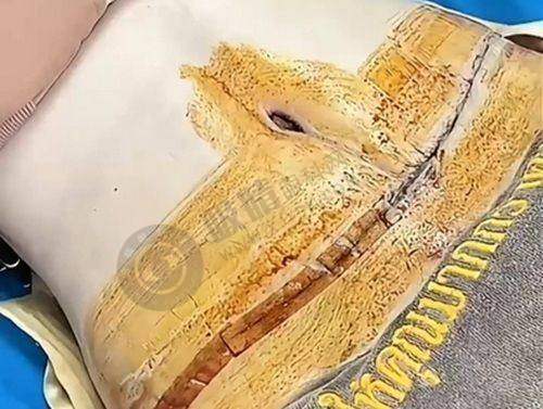 上海九院激光美容价格贵吗？2025价目表+专家团队+祛痘案例全解析