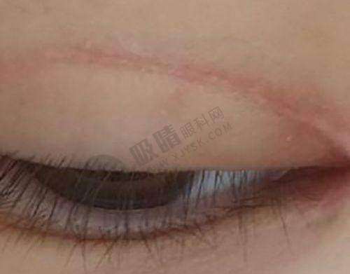 [成都友谊医院疤痕科]简介概述