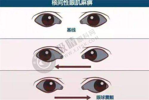 2. 李凤芝：擅长领域的佼佼者