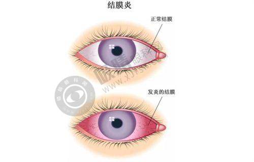 2. 擅长领域：攻克眼科难题