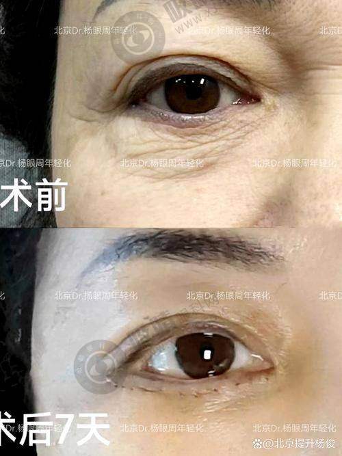 4. 杭州上颜医疗美容医院特色项目