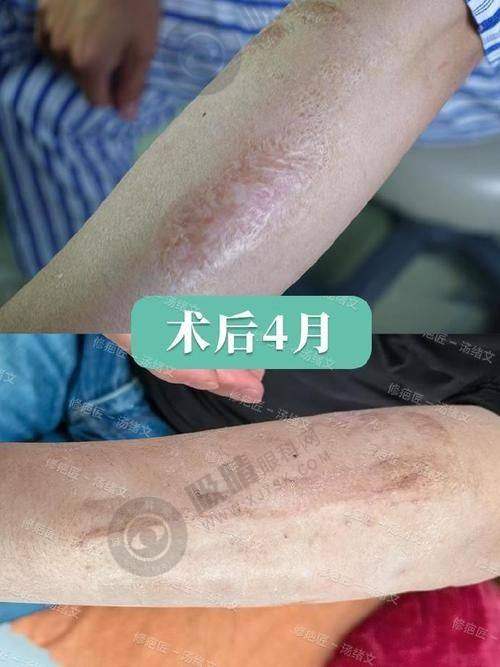 深圳鹏程医院疤痕科医院基本信息