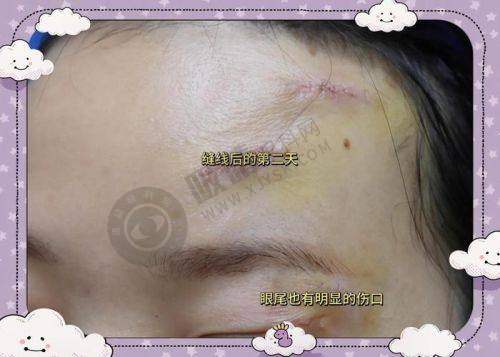 深圳鹏程医院疤痕科简介概述