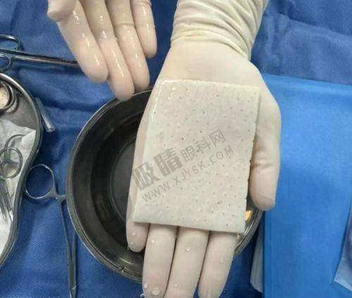 成都美容整形医院疤痕科怎么样医院价格参考