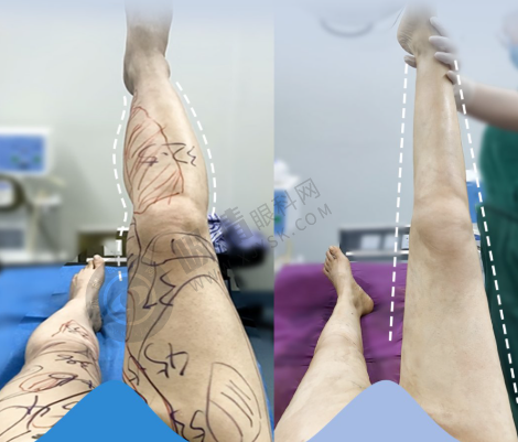 重庆美仑美奂整形口腔医院怎么样？董开云医生坐诊唇腭裂修复+耳再造手术口碑爆棚