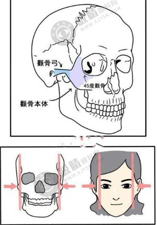 深圳做线提升医生技术与口碑总结